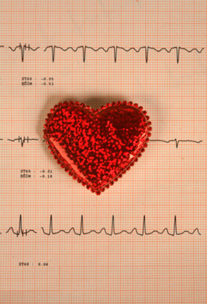 Heart Disease Is the Leading Cause of Death Amongst Women