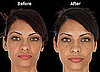 Does Selphyl Work?