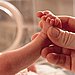 Tips for caring for a circumcised penis