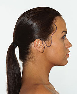 Survey Reveals Cosmetic Surgery Is Becoming More Popular For Women of Color