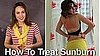 How to Treat Sunburn: Remedies and Tips on Treating Sunburn