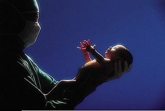 When Pregnancy Ends in Induction