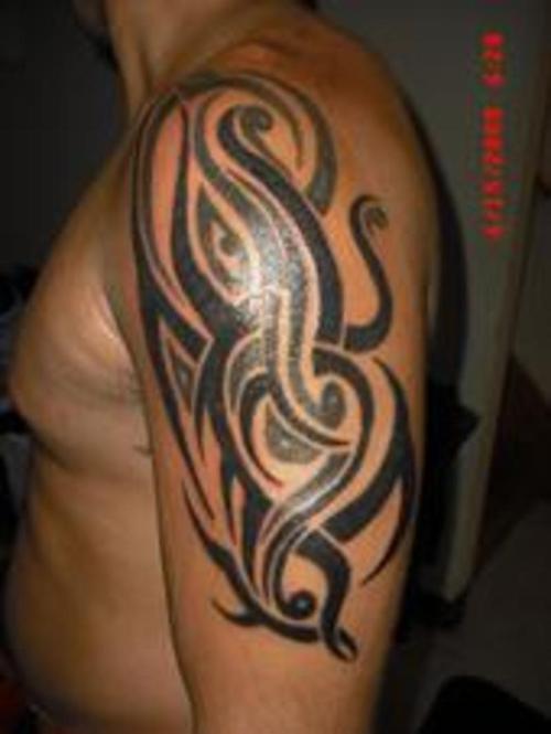 Tattoo Removal Types Of Laser Jet