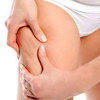 What Cellulite Treatments Work