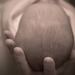 Cradle Cap