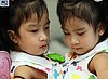 Conjoined Twins Sucessfuly Separated After Marathon Surgery (PHOTO)
