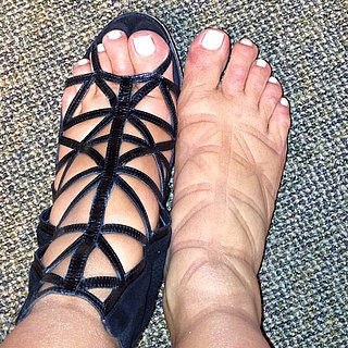 Pregnancy Swelling in 8 Weird Places