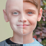 Before and After Photos of Children Cancer Survivors Will Melt Your Heart