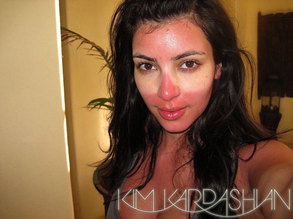 Help heal sunburned skin Help heal sunburned skin