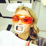 Professional Teeth Whitening Review Professional Teeth Whitening Review