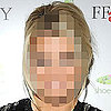 Can You Guess Which Celebrity Had Acne?  