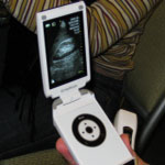 Oh Baby! Would You Buy a Portable Ultrasound Gadget? Oh Baby! Would You Buy a Portable Ultrasound Gadget?