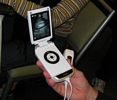 GE Introduces New Portable Ultrasound Device GE Introduces New Portable Ultrasound Device