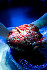The Pleasures of Placenta Keep Expanding The Pleasures of Placenta Keep Expanding