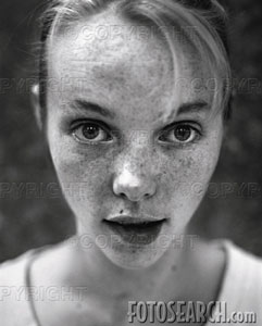 WHAT ARE THESE BROWN SPOTS ON MY FACE?