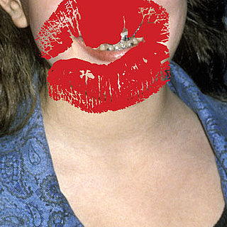 Can You Guess These Famous Brace Faces?