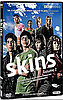 American Version of Skins Coming to MTV