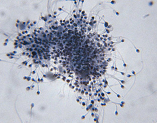 Getting Busy More May Improve Chance of Conception