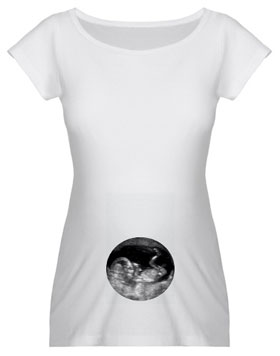 Ultrasound Tee Shirts