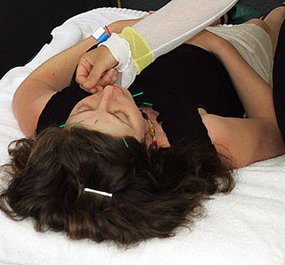 Exercise and Acupuncture Help PCOS