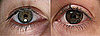 Wear Contact Lenses? Keep These in Mind