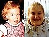Video of Kate Kane on Good Morning America Discussing Her Struggle With Prader-Willi Syndrome