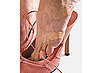 Have You Ever Had a Fashion Injury?
