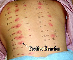 Awful Skin