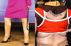 What's Worse: Cankles or Back Fat? What's Worse: Cankles or Back Fat?