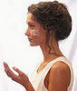 How To Treat Moderate Acne Vulgaris