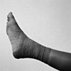This or That: Busted Leg or Facial Damage? 