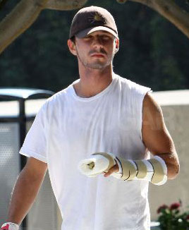 Photo of Shia LaBeouf, Whose Rep Recently Denied Reports His Pinky Is Being Amputated