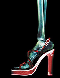 High Heels Can Be a Pain in the Neck