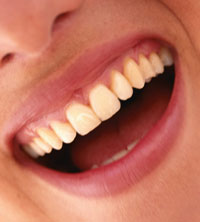 First Aid For a Knocked-Out Tooth