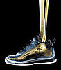 Avoid Shin Splints With Heel Walks 