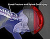 New Helmet Design For Better Injury Prevention