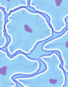 5 Things About: Fat Cells