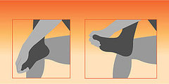 Stretch to Prevent Plantar Fasciitis Stretch to Prevent Plantar Fasciitis