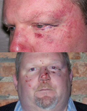 Food Critic Assaulted Outside Restaurant