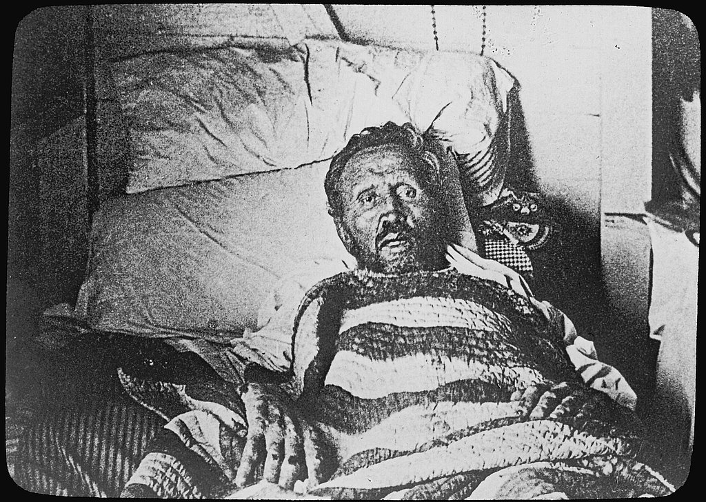 Hawaii Says "Sorry" to Leper Colonists Hawaii Says "Sorry" to Leper Colonists