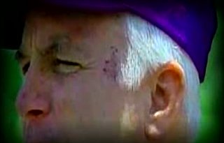 Showing McCain's Cancer Scars in Ad on Health: Ugly Tactic?