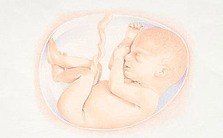 Baby Bump: Baby Born in the Caul