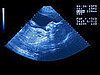 Prenatal Terms