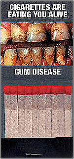 Briefing Book! NYC Hands Out Matchbooks With Rotting Gums 