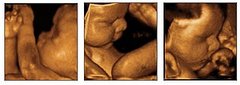 Would You Pay Out of Pocket for a 4D Ultrasound? Would You Pay Out of Pocket for a 4D Ultrasound?