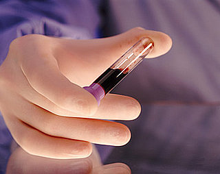 Would You Bank Your Newborn's Cord Blood? 