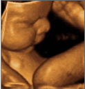 Would You Pay Out of Pocket for a 4D Ultrasound?