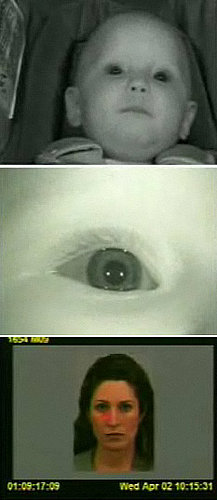 Researchers Look to Infant Eyes for Autism Diagnosis