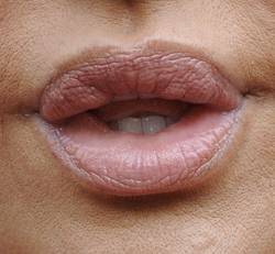 Photo of Trout Pout, Leslie Ash, Saffron Burrows, Brittany Murphy. Beauty Blog Website Plastic Surgery Lip Enhancement