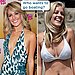 Do you think Heidi looked better before or after surgery?